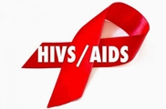 تنها راه تشخیص قطعی اچ آی وی/ایدز از طریق آزمایش خون است که در مرکز مشاوره بیماری های رفتاری بطور رایگان و محرمانه انجام می شود